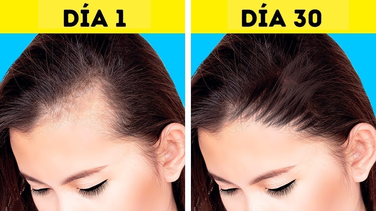 como puedo estimular el crecimiento de pelo nuevo en la cabeza