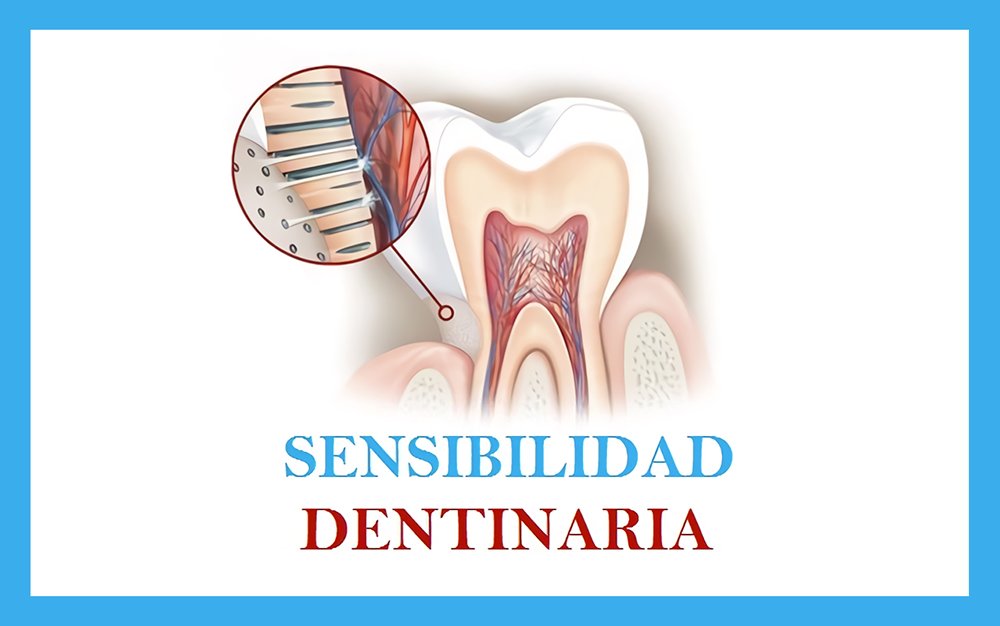 Por Qué Tengo Sensibilidad Dental Sin Comer Nada 3583